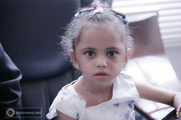 «صالح» يلتقي الطفلة بثينة الريمي الناجية الوحيدة من أسرتها (صور)