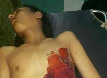 ستة أشخاص يرتكبون جريمة بشعة في إب بحق الطفل بشار العفيف ما ادى إلى وفاته (صورة)
