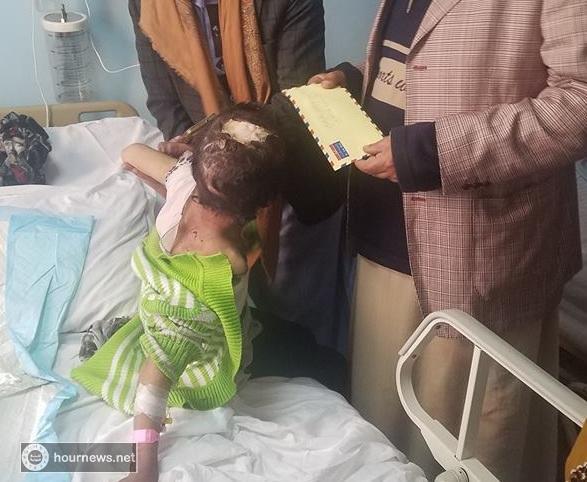 جريمة بشعة.. تعذيب جنوني وبشع للطفلة تيسير من قبل والدها وزوجته.. وهذا ما حدث! (صور + فيديو)