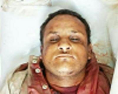 مقتل القيادي الحوثي "المتوكل" في تعز مع عدد من مرافقيه