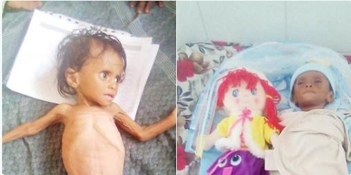 وفاة طفلة نازحة جوعاً في عدن.. ونازحون يسكنون المقابر