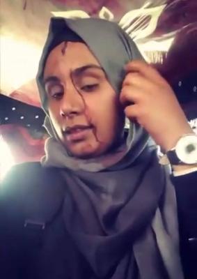 فيديو.. تسجيل مصور لإحدى طالبات جامعة صنعاء وهي مضرجة بالدماء بعد الاعتداء عليها 