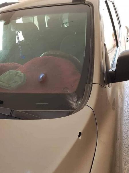 قائد رفيع في الجيش اليمني ينجو من محاولة اغتيال (صور)