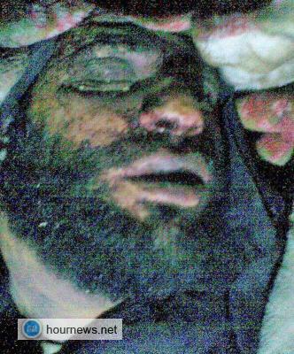 أحمد أبو محيسن يلقى ربه شهيداً في حلب