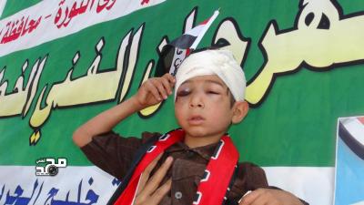 اعتبرته اعتداء على براءة الطفولة  إب..منظمة هود تدين اعتداءات ميليشيات محمد أحمد منصور بحق الطفل نادر خالد قاسم وتطالب السلطة المحلية والأمنية والنيابة العامة با المحافظة بسرعة ضبط الجناة والتحقيق في الواقعة
