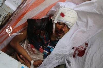 بالصورة"مقتل مصور قناة اليمن الفضائية في تعز 