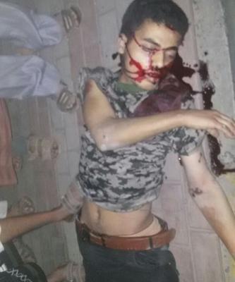 شاهد بالصورة.. جريمة دهس مروعة لشاب في العاصمة صنعاء بطلها طقم حوثي