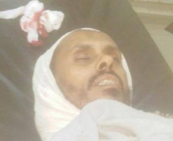 اغتيال شيخاً سلفيا في مدينة جعار بأبين برصاص مجهولين (صورة)