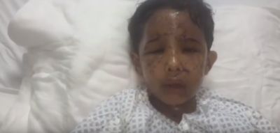 بالفيديو.. طفل  سعودي يروي لحظة إصابته بمقذوف من اليمن وفقدان صديقه