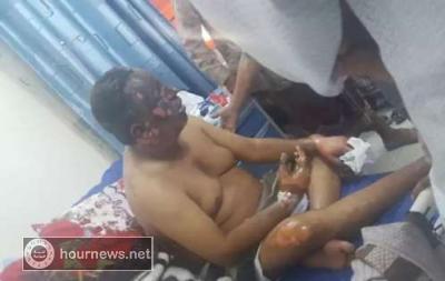 إصابة قائد جهاز نزع الالغام في جبهة ذوباب "صورة