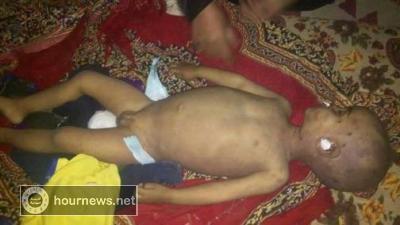 بعد ان قام بتعذيبه وقطع لسانه .. مقتل طفل على يد والده بصنعاء