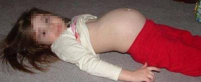 حدث في بلد عربي.. طفلة حامل في شهرها الثامن!!