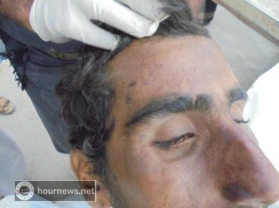 تعذيب شاب بالصعق بالكهرباء حتى الموت في محافظة مأرب (صور ) تعذيب شاب بالصعق بالكهرباء حتى الموت في محافظة مأرب (صور )