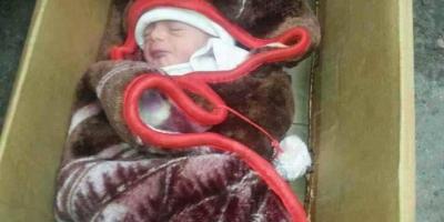  مواطنون يعثرون على طفل صغير مرمي في قارعة الطريق في محافظة إب ” صور