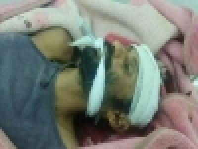  شاهد بالصورة .. جريمة جديدة وبشعة تهز مدينة عدن