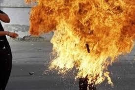  مواطن يحرق نفسه وسط الشارع في العاصمة صنعاء
