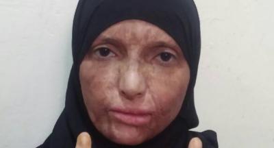 لكل المغتربين.. تعرف على "الشيطان" الذي ضحك على الفتاة اليمنية ودمر حياتها!(صور)