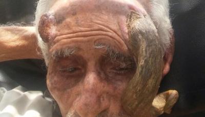 بالفيديو : قطع قرن أكبر معمر في اليمن عمره 140 سنة مما تسبب في وفاته