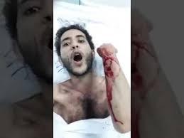 طبيب سعودي يعتدي على يمني بالضرب داخل مستشفى حكومي"شاهد