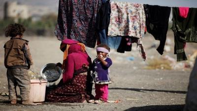 تقرير بريطاني التحالف العربي السبب في انتشار الكوليرا في اليمن