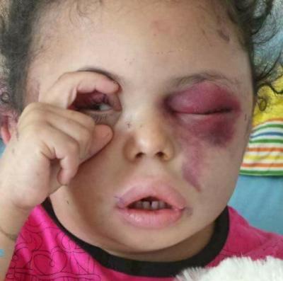 ناشطون يدشنون حملة #بثينه_عين_الانسانية 