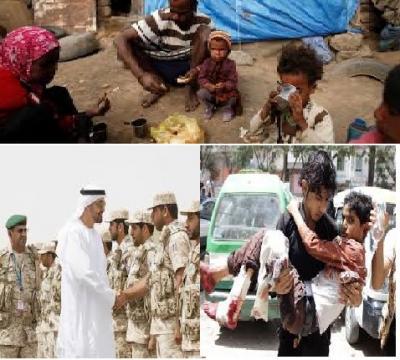 تقرير ناري لقناة الجزيرة ، يكشف سرّا جديدا من معاناة المواطنيين والانتهاكات التي يتعرضون لها في موزع على يد قوات أبوظبي