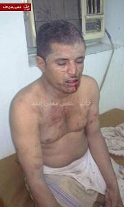 تعذيب مسؤول أمني في عدن بعد اختطافه
