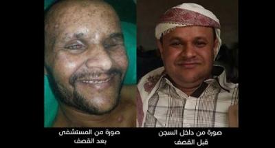 صحفي يكشف عن قصة مختطف لدى الحوثيون يرفضون الإفراج عنه ...تفاصيل
