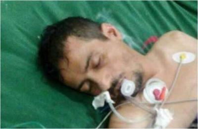 الحوثيون يعذبون قيادي إصلاحي حتى الموت "الاسم +الصورة 