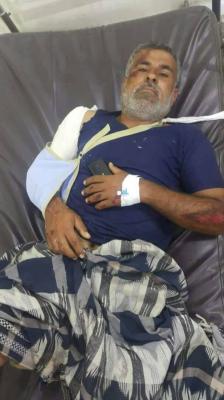 جرحى في انقلاب طقم عسكري بالمخا
