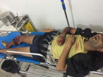 قتلى وجرحى بتفجير عبوة ناسفة بتعز