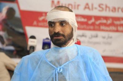 التفاصيل الكاملة لتعذيب الدكتور الشرقي من قبل المليشيا الحوثية