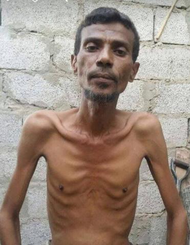 وفاة فنان تهامي بسبب الجوع وناشطون ينشرون آخر صورة له قبل الوفاة