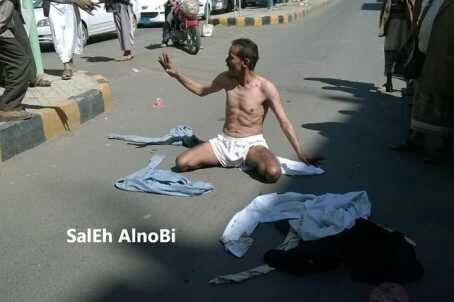 جندي يمني يخلع ملابسه ويقطع أحد الشوارع بصنعاء بعد تعرضه للضرب بمقر عمله من قبل الحوثيين.صوره.