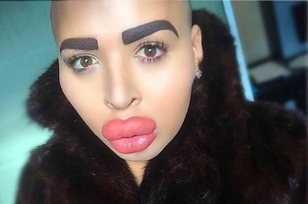 أنفَقَ 150 ألف دولار على عمليات التجميل ليشبه “كيم كاردشيان”