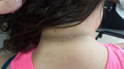 اعرفها حالاً :10 علامات تساعدك في الكشف المبكر عن الإصابة بمرض السكري