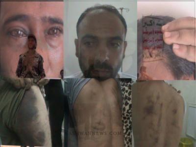 لأول مرة أرقام ومعلومات مذهلة تحكي قصص التعذيب الوحشي في سجون السيد بصعده ( تقرير موسع ) 