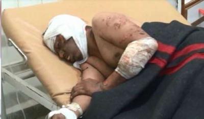 ثلاثون قتيلاً وعشرات الجرحى في غارة استهدفت مدينة حوث