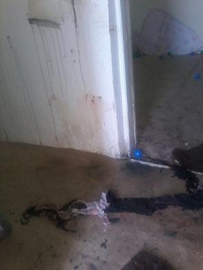 بحادثة مروعة : مجهول يسكب مادة حارقة على فتاة ووالدتها في منزلهما بمكة السعودية