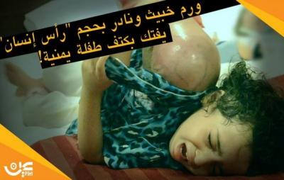 بعد عرض الفنان السعودي "فايز المالكي" سيارته للبيع من اجل علاج طفلة يمنية .. الديوان الملكي يتكفل بعلاجها
