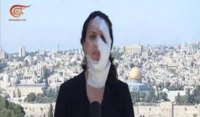 موقع إسرائيلي يوثق لمراسلة فلسطينية: أصيبت من قنبلة وعادت للبث