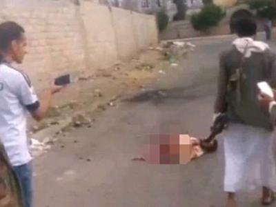 العثور على انتحاري "داعشي" مشطور نصفين ومازال حيا في اليمن | صور + فيديو