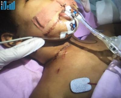 شاهد بالصورة.. خادمة إثيوبية حاولت قطع رأس طفل.. والأم تنقذه بأعجوبة