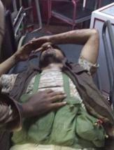 اصابة القيادي في المقاومة الجنوبية ابو مشعل الكازمي في اشباكات زنجبار (صورة)