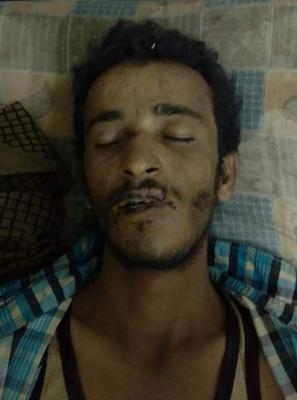 جريمة شنيعة يندى لها الجبين في حق شخص يفقد نصف حواسهِ الخمس في عدن