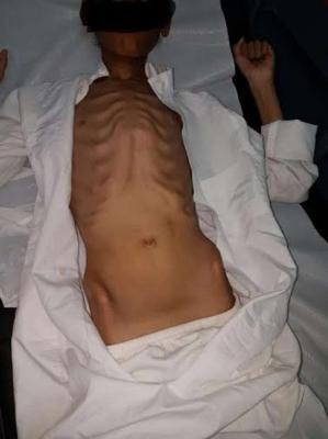 شاهد صور مؤلمة في حادثة لم يسبق لها مثيل.. "أم" تحبس أبناءها في غرفة بسطح المنزل في "المدينة المنورة" وتمنع عنهم الطعام