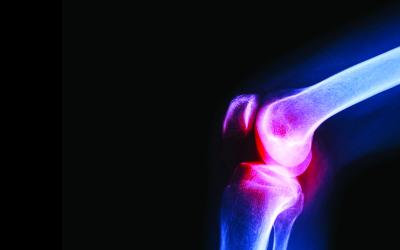 بشرى طبية وإنجازاً طبياً مبتكراً: 93% نجاح حقن الدهون لعلاج آلام المفاصل والركبة