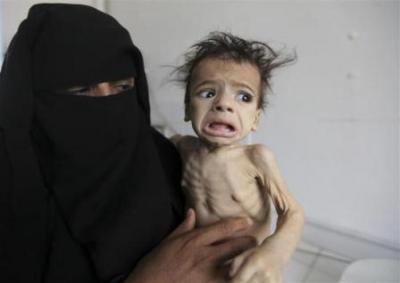 الأمم المتحدة تقدم هدية ثمينة لليمنيين الجياع