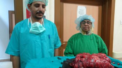 استخراج ورم يزن 5.5 كيلوجرام من رحم فتاة عذراء      