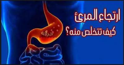 دراسة تؤكد فاعلية بيكربونات الصودا لعلاج الحموضة وارتجاع المريء